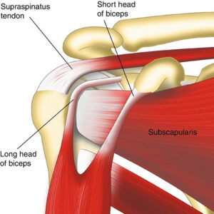 Biceps Tendon Injuries - Zahab Ahsan, MD